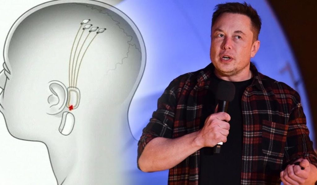 Potvrdené Elonom Muskom: Neuralink začne implantovať zariadenia slepým ľuďom na obnovenie zraku: „Je to ako superschopnosť“